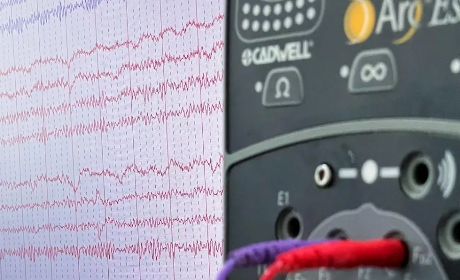المركز الطبي الجامعي يطلق خدمة تخطيط الأعصاب بالتعاون مع كلية الطب - 2