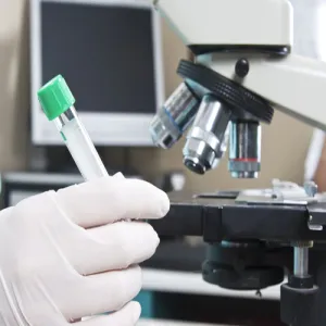 THE FIRST SAUDI STUDENT FROM THE COLLEGE OF APPLIED MEDICAL SCIENCES OF MAJMAAH UNIVERSITY, PARTICIPATE IN THE DISCOVERY OF THE TREATMENT OF HEALING DIABETIC FOOT USING NANO-SILVER TECHNOLOGY AND STEM CELLS
